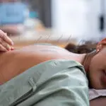 Performing acupuncture on a patients back.A close-up of a patient receiving acupuncture an treatment on the back.Acupuncture back treatment.